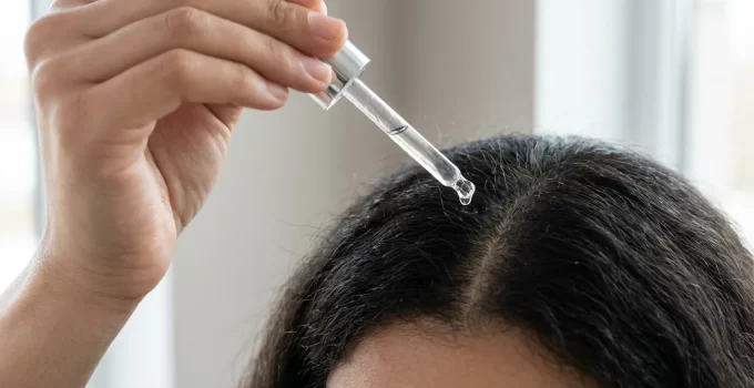 Topical Hair Regrowth Treatment Protocols: Best Practices