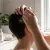 Hair Regrowth Treatment: Patient Experiences and Insights